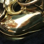 dent-after